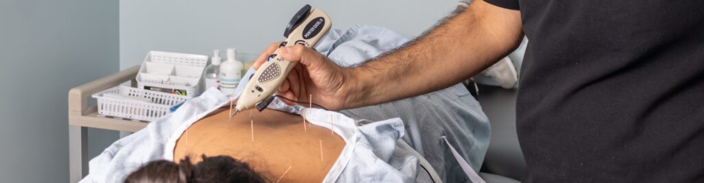 dry-needling-Apex-Physiotherapy-and-Health-Clinic-Abbotsford-Surrey-BC-1920x500