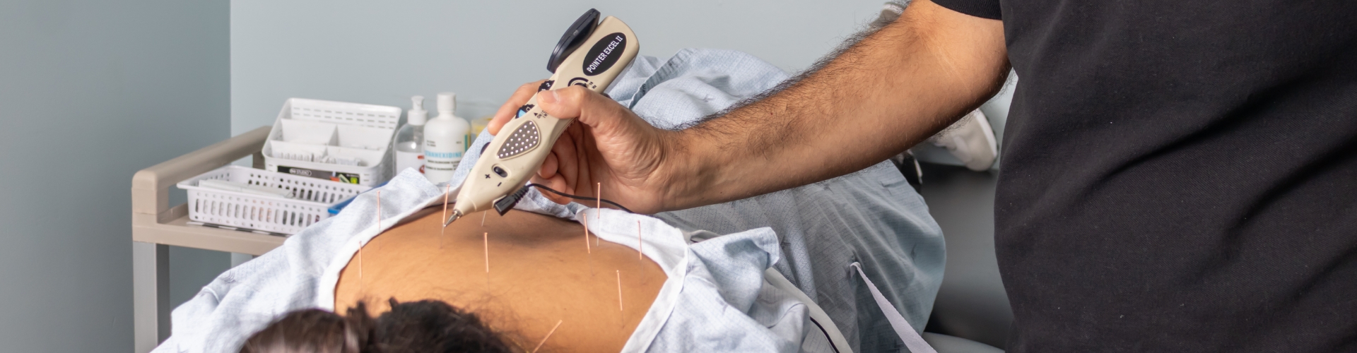 Dry Needling